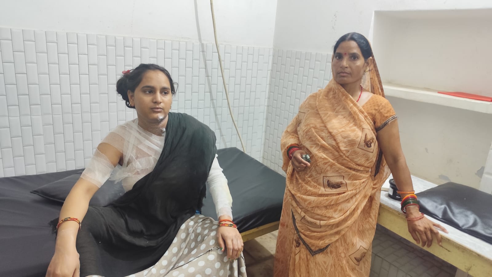 दहेज लोभी पति के आग लगाने से पत्नी हुई गम्भीर रूप से घायल